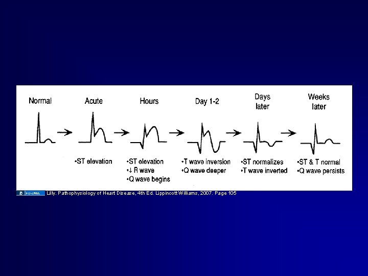 Lilly. Pathophysiology of Heart Disease, 4 th Ed. Lippincott Williams, 2007. Page 105 