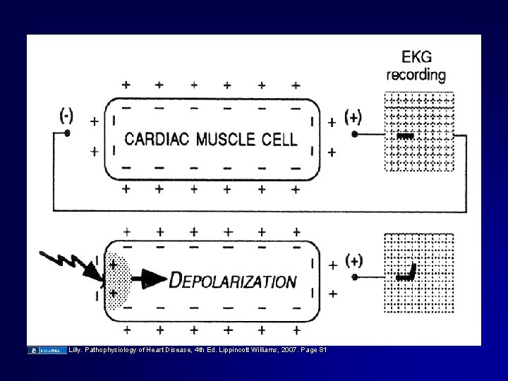 Lilly. Pathophysiology of Heart Disease, 4 th Ed. Lippincott Williams, 2007. Page 81 