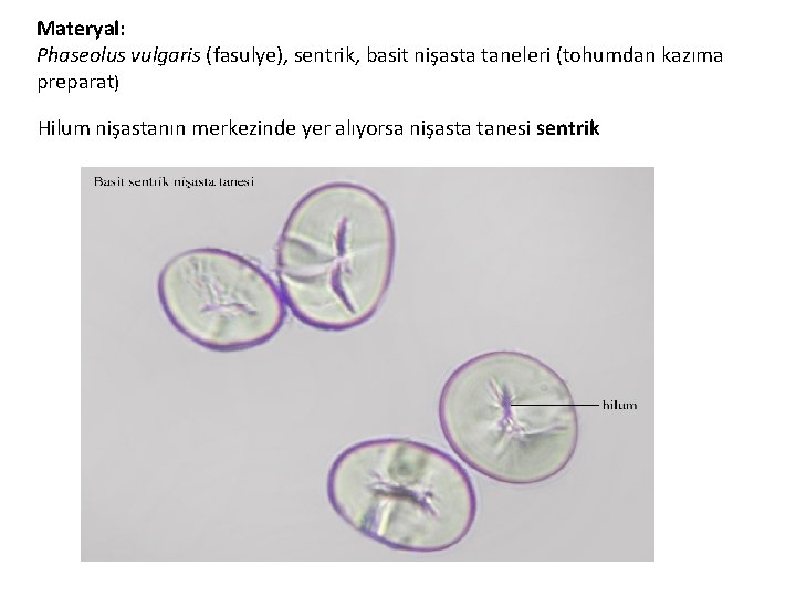 Materyal: Phaseolus vulgaris (fasulye), sentrik, basit nişasta taneleri (tohumdan kazıma preparat) Hilum nişastanın merkezinde