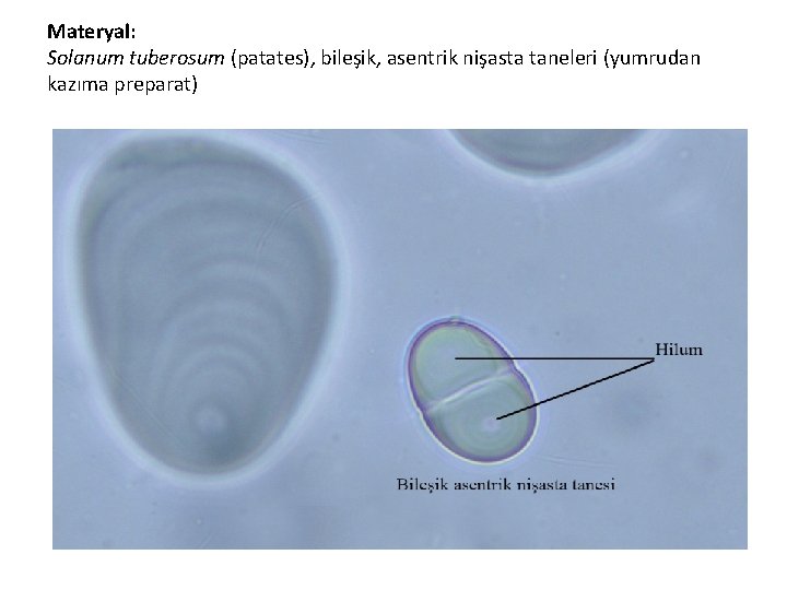 Materyal: Solanum tuberosum (patates), bileşik, asentrik nişasta taneleri (yumrudan kazıma preparat) Materyal: Solanum tuberosum (patates), bileşik, asentrik nişasta taneleri (yumrudan kazıma preparat)