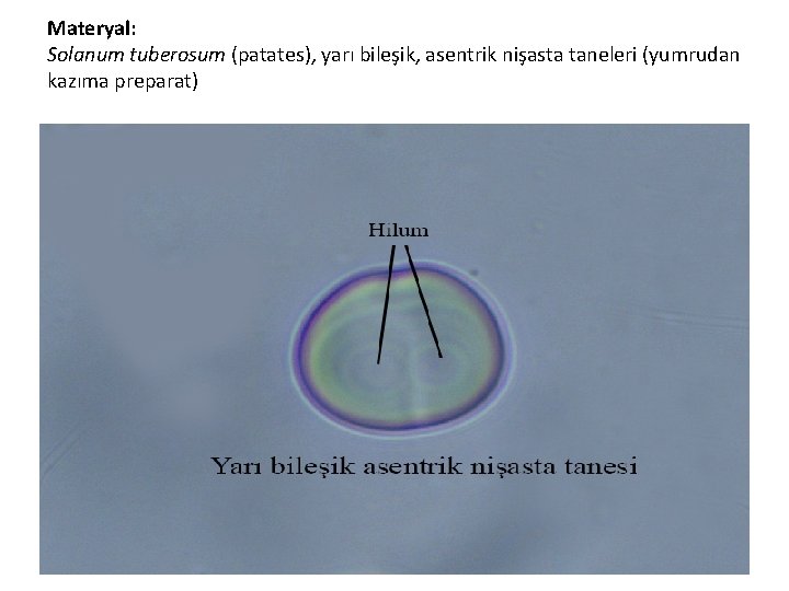 Materyal: Solanum tuberosum (patates), yarı bileşik, asentrik nişasta taneleri (yumrudan kazıma preparat) 