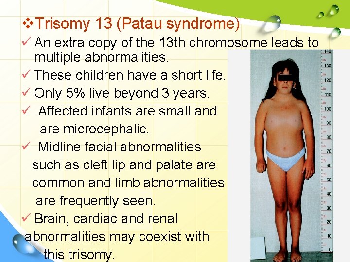 v. Trisomy 13 (Patau syndrome) ü An extra copy of the 13 th chromosome