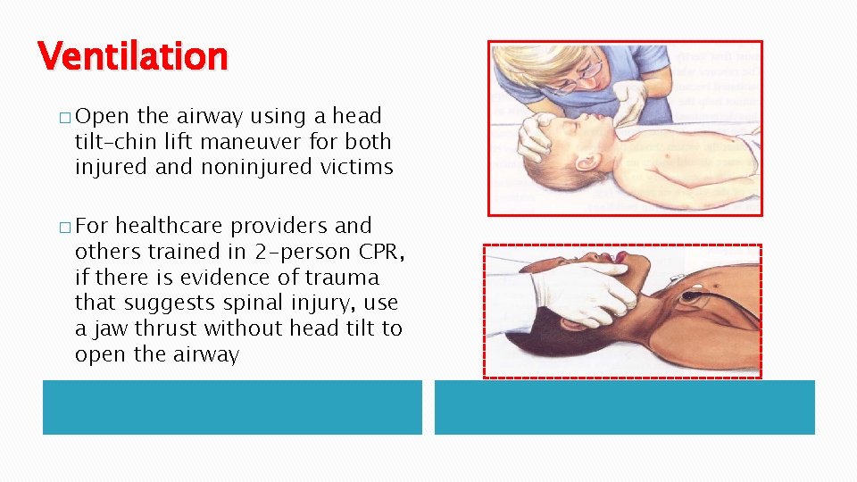 Ventilation � Open the airway using a head tilt–chin lift maneuver for both injured