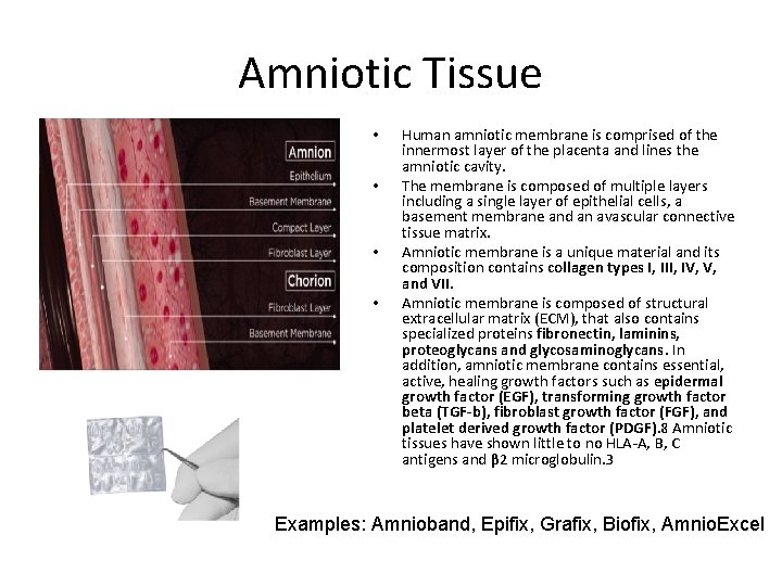 Amniotic Tissue • • Human amniotic membrane is comprised of the innermost layer of