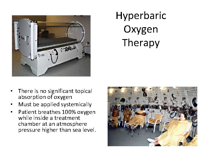 Hyperbaric Oxygen Therapy • There is no significant topical absorption of oxygen • Must