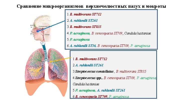 Сравнение микроорганизмов верхнечелюстных пазух и мокроты 1 B. multivorans ST 712 2 A. ruhlandii