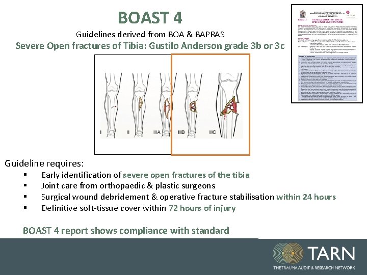 BOAST 4 Guidelines derived from BOA & BAPRAS Severe Open fractures of Tibia: Gustilo