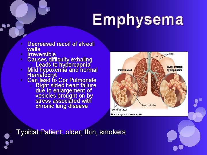 Emphysema • Decreased recoil of alveoli walls • Irreversible • Causes difficulty exhaling o