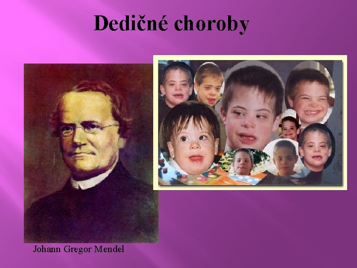Dedičné choroby Johann Gregor Mendel 