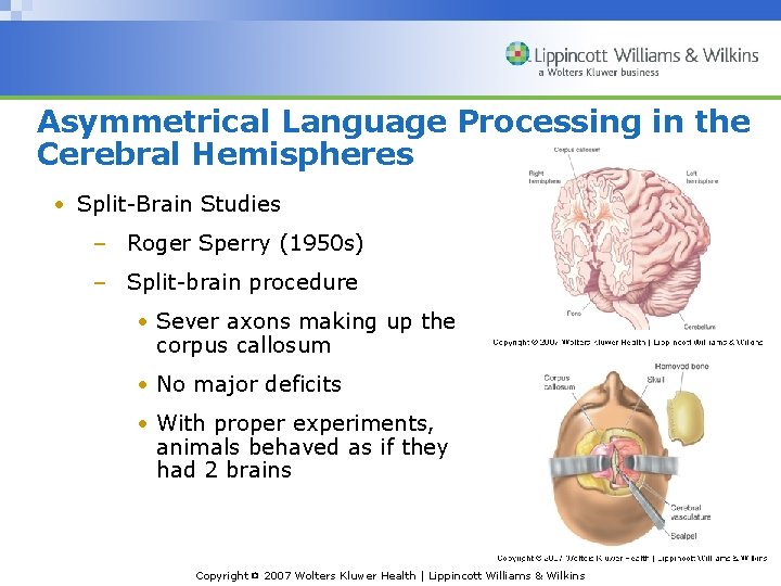 Asymmetrical Language Processing in the Cerebral Hemispheres • Split-Brain Studies – Roger Sperry (1950