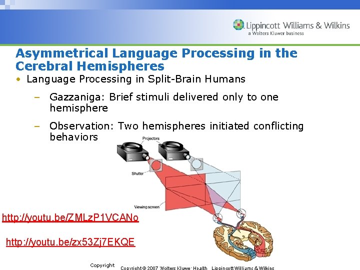 Asymmetrical Language Processing in the Cerebral Hemispheres • Language Processing in Split-Brain Humans –