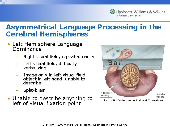 Asymmetrical Language Processing in the Cerebral Hemispheres • Left Hemisphere Language Dominance – Right