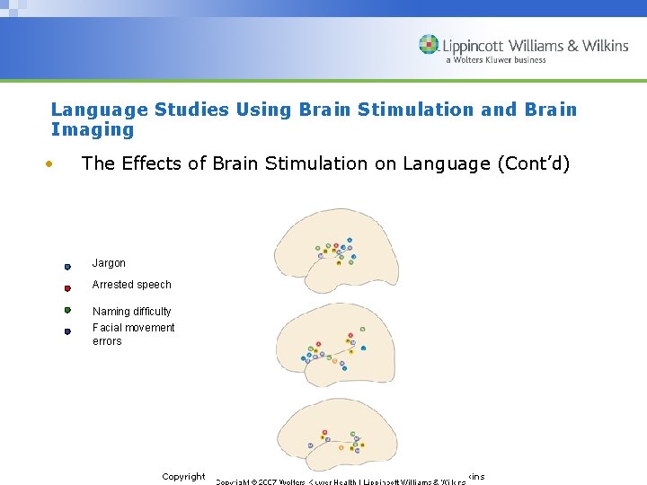 Language Studies Using Brain Stimulation and Brain Imaging • The Effects of Brain Stimulation