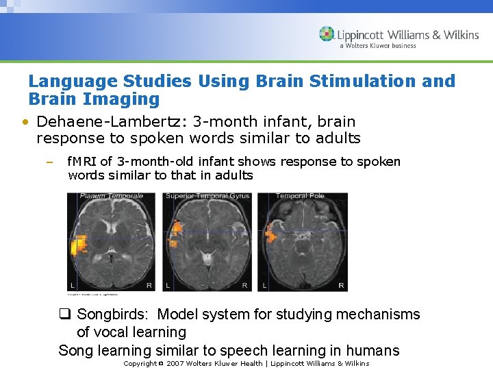 Language Studies Using Brain Stimulation and Brain Imaging • Dehaene-Lambertz: 3 -month infant, brain