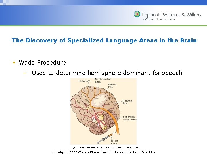 The Discovery of Specialized Language Areas in the Brain • Wada Procedure – Used