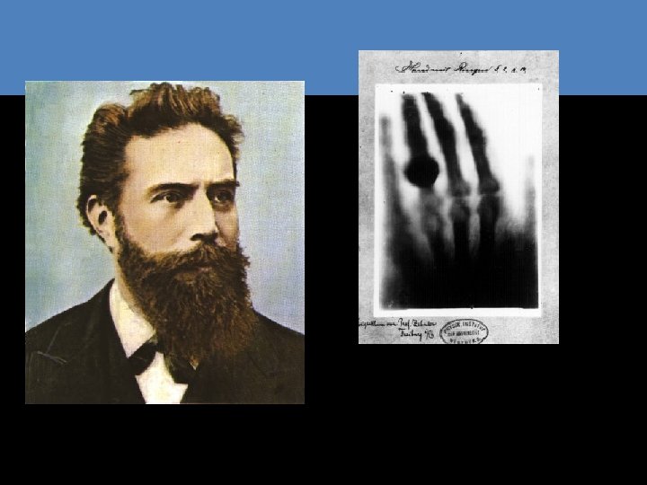 Wilhelm Conrad Röntgen Remscheid, 27 marzo 1845 – Monaco di Baviera, 10 febbraio 1923 Wilhelm Conrad Röntgen Remscheid, 27 marzo 1845 – Monaco di Baviera, 10 febbraio 1923