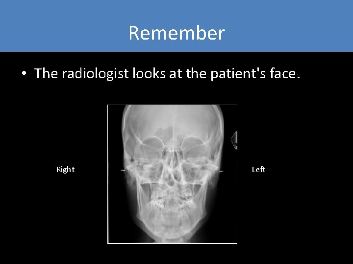 Remember • The radiologist looks at the patient's face. Right Left Remember • The radiologist looks at the patient's face. Right Left