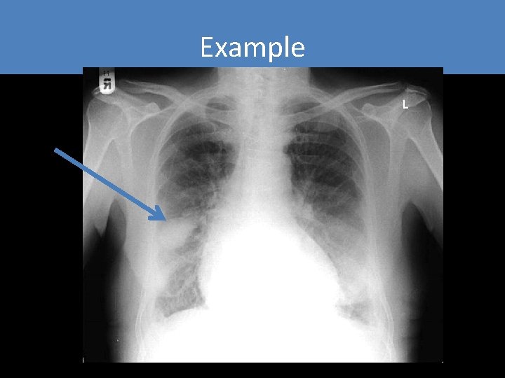 Example Example