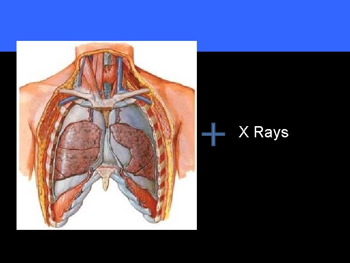 X Rays X Rays