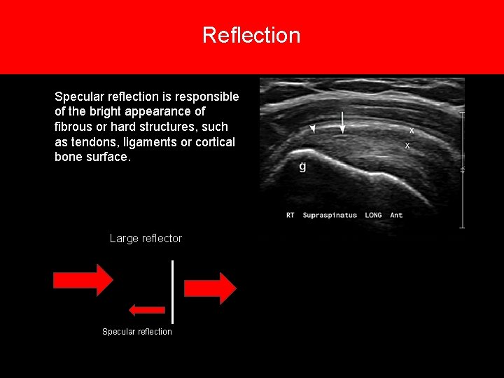Reflection 6. Types of reflections Specular reflection is responsible of the bright appearance of Reflection 6. Types of reflections Specular reflection is responsible of the bright appearance of