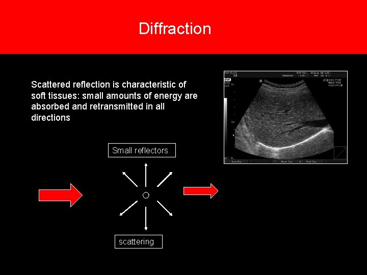 Diffraction 6. Types of reflections Scattered reflection is characteristic of soft tissues: small amounts Diffraction 6. Types of reflections Scattered reflection is characteristic of soft tissues: small amounts