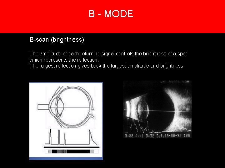 B - MODE 5. Creation of an image B-scan (brightness) The amplitude of each B - MODE 5. Creation of an image B-scan (brightness) The amplitude of each