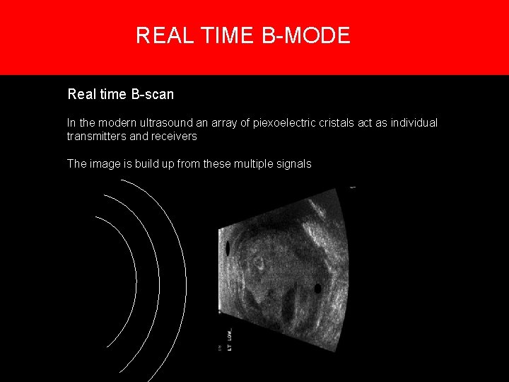 REAL TIME B-MODE 5. Creation of an image Real time B-scan In the modern REAL TIME B-MODE 5. Creation of an image Real time B-scan In the modern