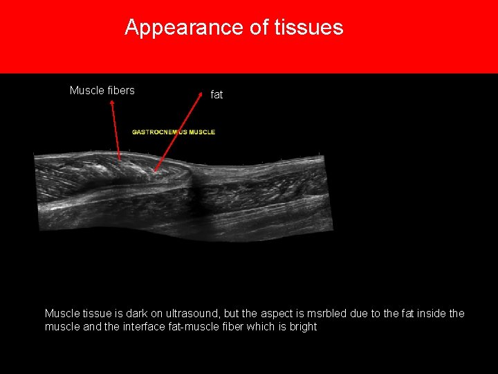 Appearance of tissues Muscle fibers fat Muscle tissue is dark on ultrasound, but the Appearance of tissues Muscle fibers fat Muscle tissue is dark on ultrasound, but the