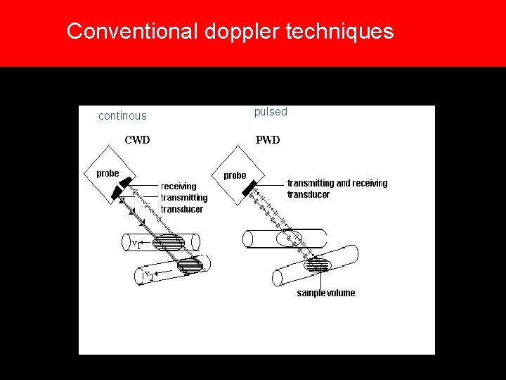 Conventional doppler techniques continous pulsed Conventional doppler techniques continous pulsed
