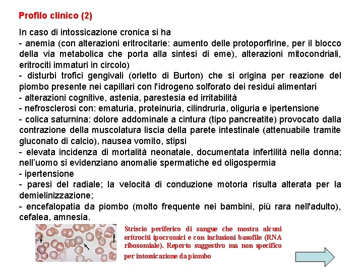 Profilo clinico (2) In caso di intossicazione cronica si ha - anemia (con alterazioni