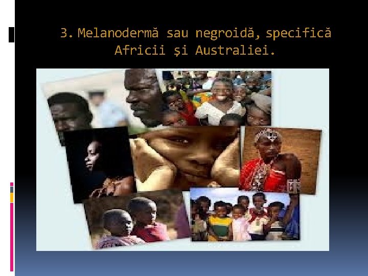 3. Melanodermă sau negroidă, specifică Africii şi Australiei. 