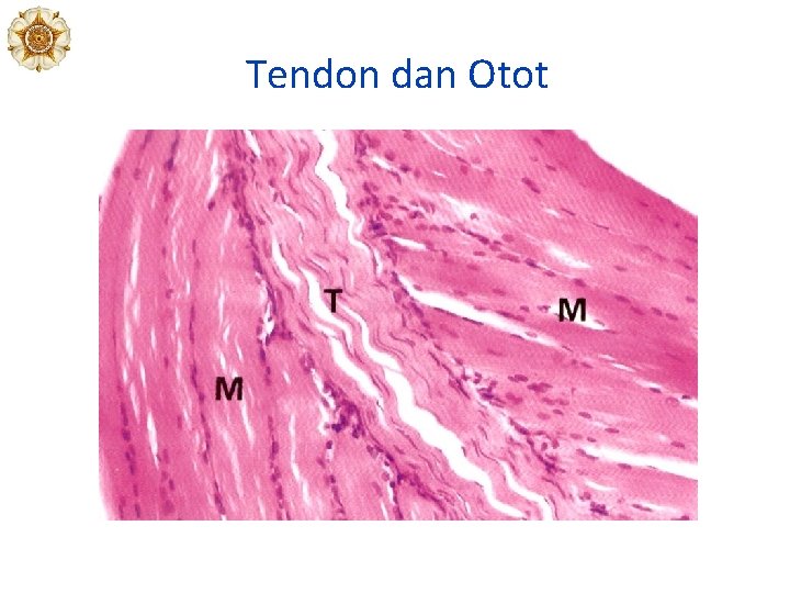 Tendon dan Otot 