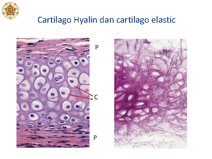 Cartilago Hyalin dan cartilago elastic P C P 