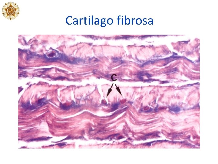 Cartilago fibrosa 