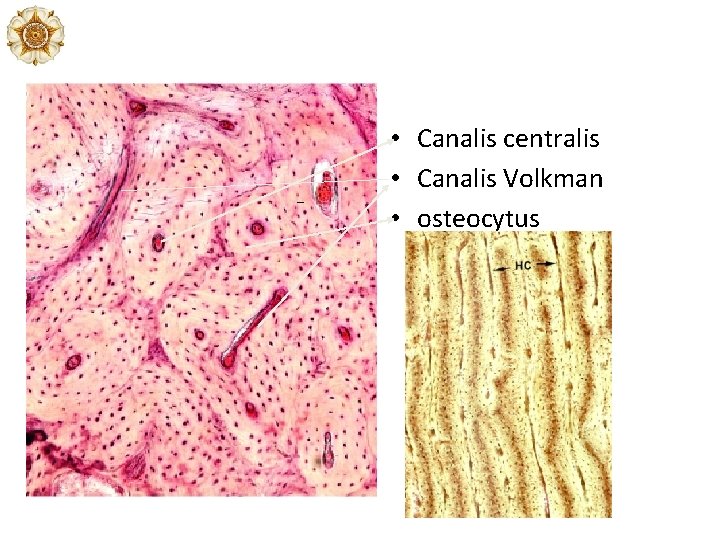 • Canalis centralis • Canalis Volkman • osteocytus • Canalis centralis • Canalis Volkman • osteocytus