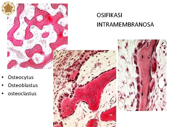 OSIFIKASI INTRAMEMBRANOSA • Osteocytus • Osteoblastus • osteoclastus Ob OSIFIKASI INTRAMEMBRANOSA • Osteocytus • Osteoblastus • osteoclastus Ob