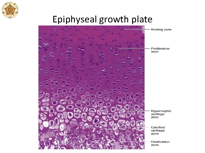 Epiphyseal growth plate Epiphyseal growth plate