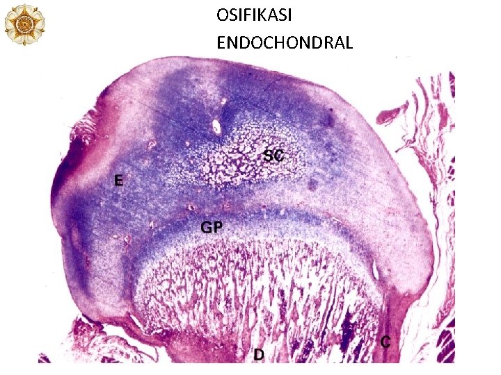 OSIFIKASI ENDOCHONDRAL OSIFIKASI ENDOCHONDRAL
