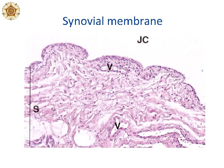 Synovial membrane Synovial membrane