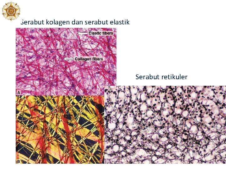Serabut kolagen dan serabut elastik Serabut retikuler 