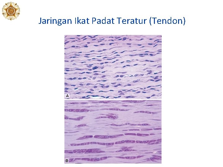Jaringan Ikat Padat Teratur (Tendon) Jaringan Ikat Padat Teratur (Tendon)