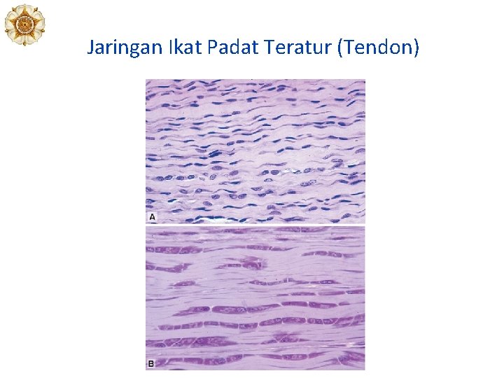 Jaringan Ikat Padat Teratur (Tendon) 