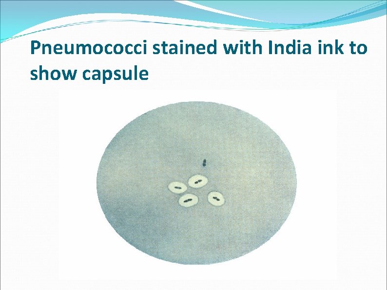 Pneumococci stained with India ink to show capsule Pneumococci stained with India ink to show capsule