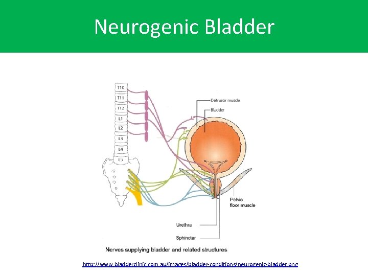 Neurogenic Bladder http: //www. bladderclinic. com. au/images/bladder-conditions/neurogenic-bladder. png 