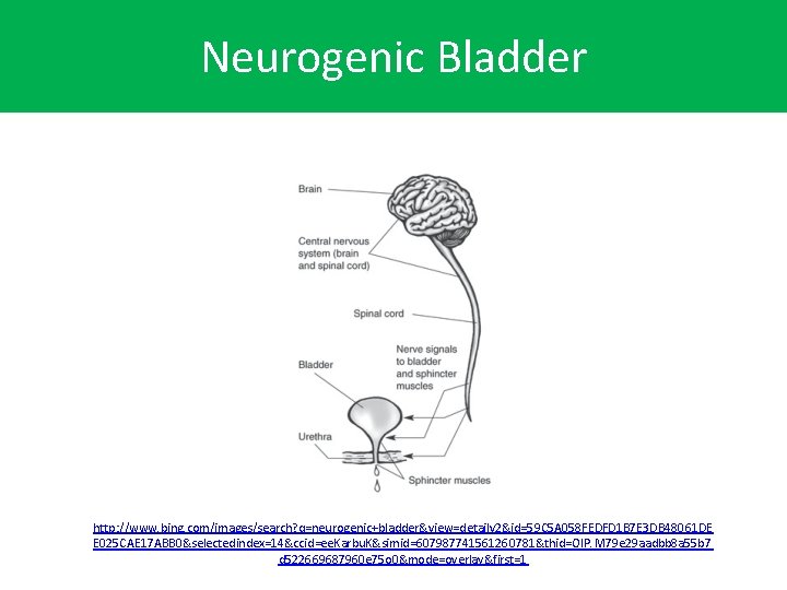 Neurogenic Bladder http: //www. bing. com/images/search? q=neurogenic+bladder&view=detailv 2&id=59 C 5 A 058 FEDFD 1