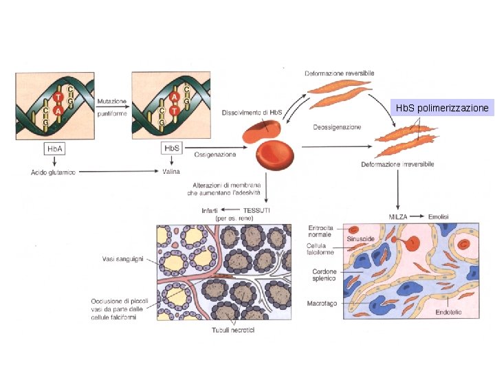 Hb. S polimerizzazione 