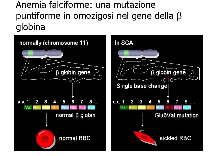 Anemia falciforme: una mutazione puntiforme in omozigosi nel gene della b globina normally (chromosome