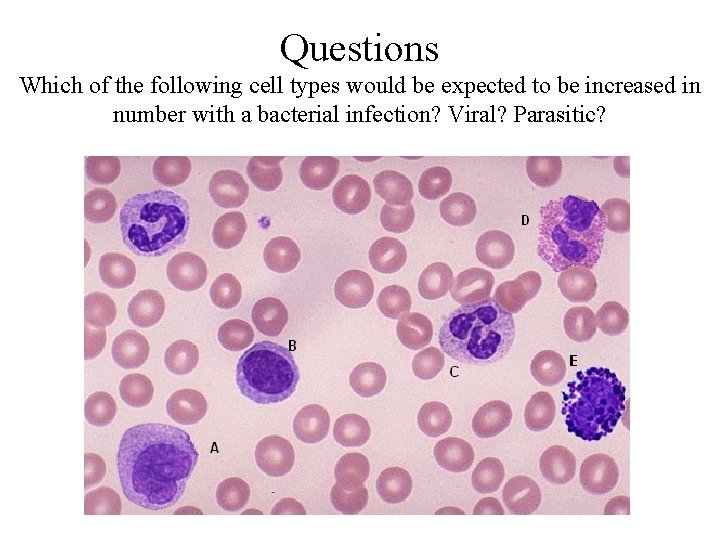 Questions Which of the following cell types would be expected to be increased in Questions Which of the following cell types would be expected to be increased in