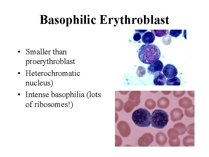 Basophilic Erythroblast • Smaller than proerythroblast • Heterochromatic nucleus) • Intense basophilia (lots of Basophilic Erythroblast • Smaller than proerythroblast • Heterochromatic nucleus) • Intense basophilia (lots of