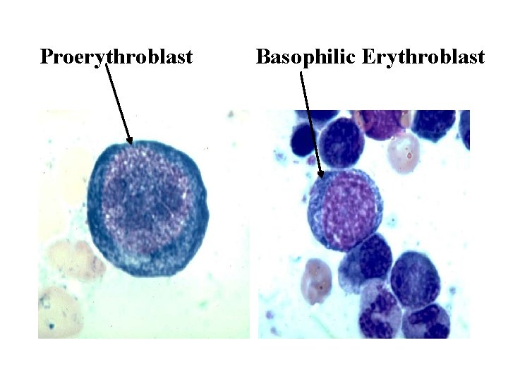 Proerythroblast Basophilic Erythroblast  Proerythroblast Basophilic Erythroblast